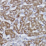 Immunohistochemistry - Anti-COX6B1 Antibody [ARC2568] (A306867) - Antibodies.com