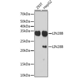 Western Blot - Anti-Lin28B Antibody [ARC1616] (A306869) - Antibodies.com