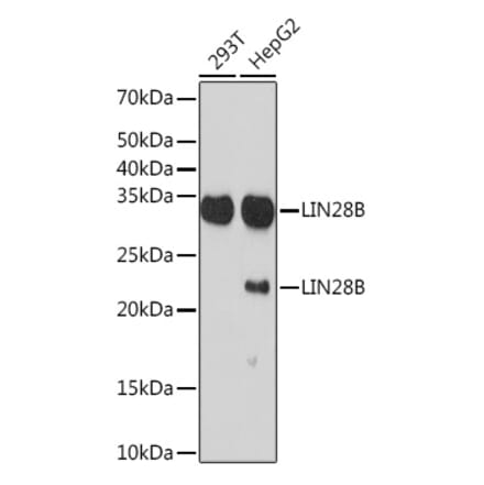 Western Blot - Anti-Lin28B Antibody [ARC1616] (A306869) - Antibodies.com