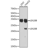 Western Blot - Anti-Lin28B Antibody [ARC1616] (A306869) - Antibodies.com