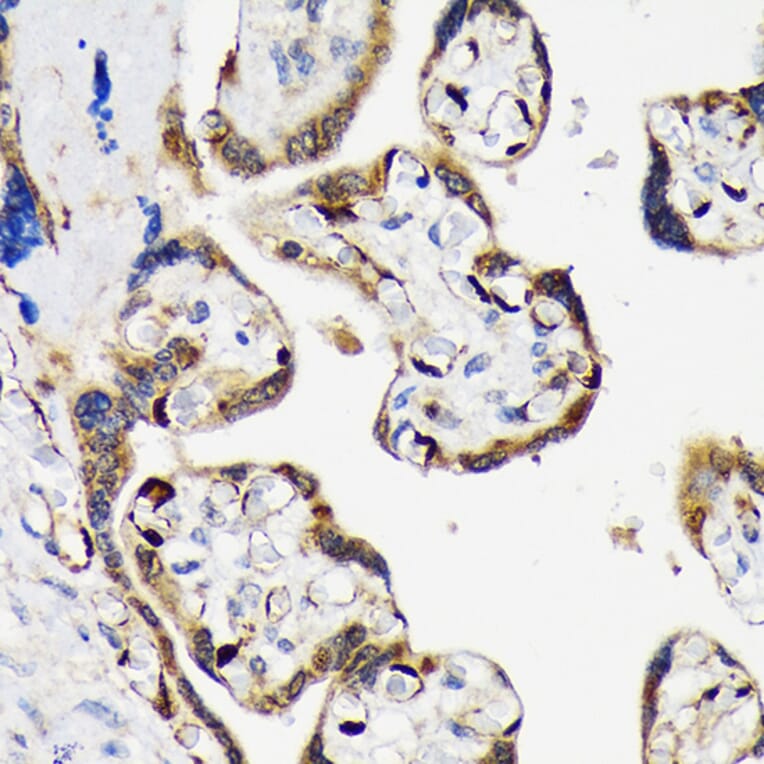 Immunohistochemistry - Anti-Lin28B Antibody [ARC1616] (A306869) - Antibodies.com