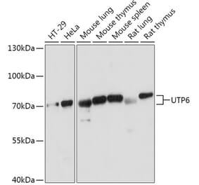 Western Blot - Anti-UTP6 Antibody (A306870) - Antibodies.com