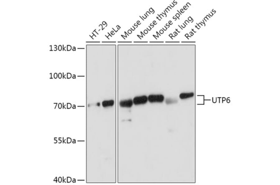 Western Blot - Anti-UTP6 Antibody (A306870) - Antibodies.com