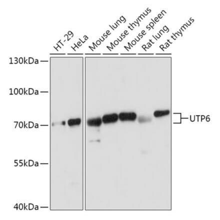 Western Blot - Anti-UTP6 Antibody (A306870) - Antibodies.com