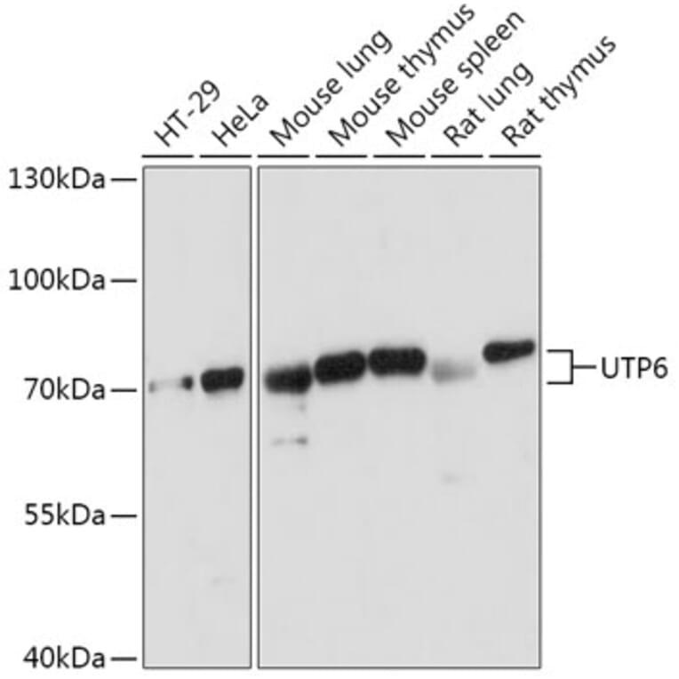 Western Blot - Anti-UTP6 Antibody (A306870) - Antibodies.com