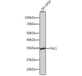 Western Blot - Anti-FHL1 Antibody [ARC1238] (A306871) - Antibodies.com