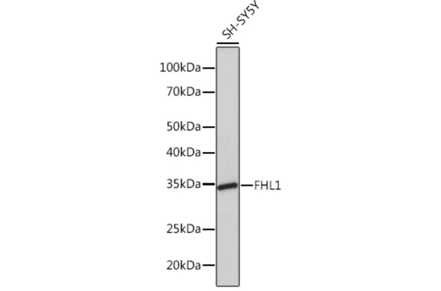 Western Blot - Anti-FHL1 Antibody [ARC1238] (A306871) - Antibodies.com