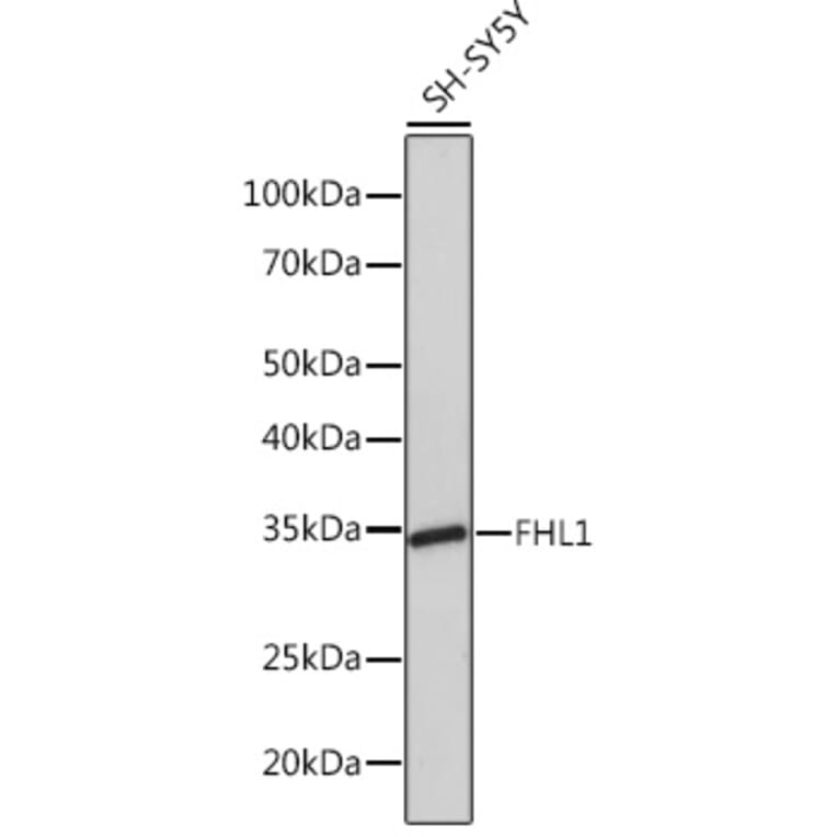 Western Blot - Anti-FHL1 Antibody [ARC1238] (A306871) - Antibodies.com