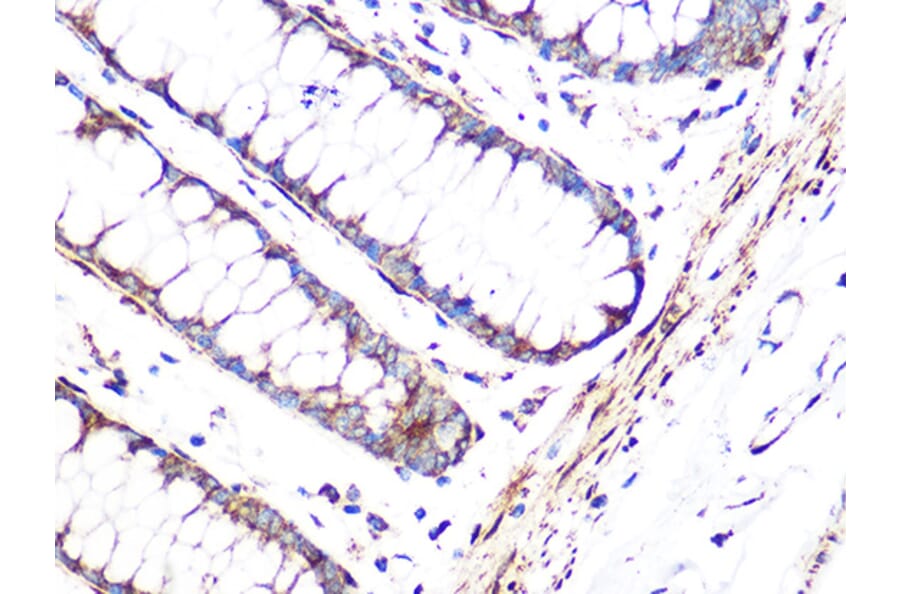 Immunohistochemistry - Anti-FHL1 Antibody [ARC1238] (A306871) - Antibodies.com