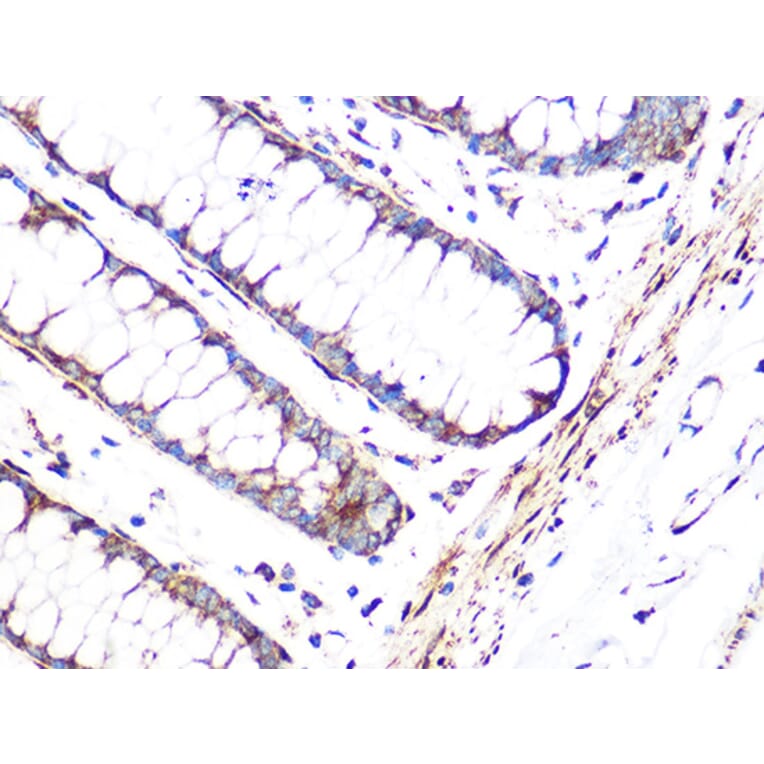 Immunohistochemistry - Anti-FHL1 Antibody [ARC1238] (A306871) - Antibodies.com