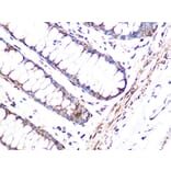 Immunohistochemistry - Anti-FHL1 Antibody [ARC1238] (A306871) - Antibodies.com