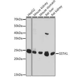 Western Blot - Anti-GSTA1 Antibody (A306872) - Antibodies.com
