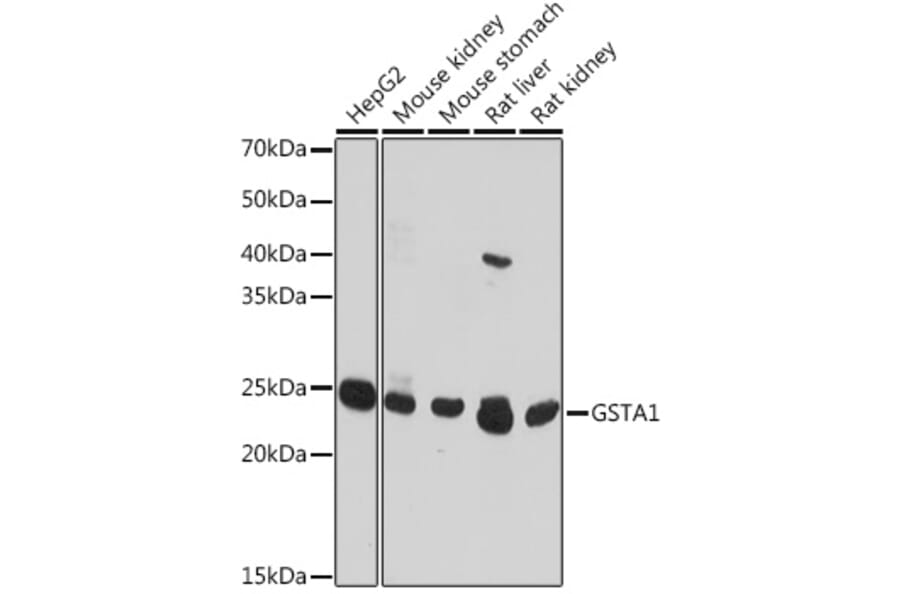 Western Blot - Anti-GSTA1 Antibody (A306872) - Antibodies.com