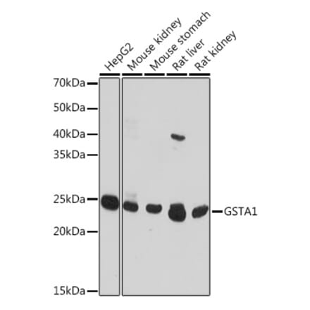 Western Blot - Anti-GSTA1 Antibody (A306872) - Antibodies.com