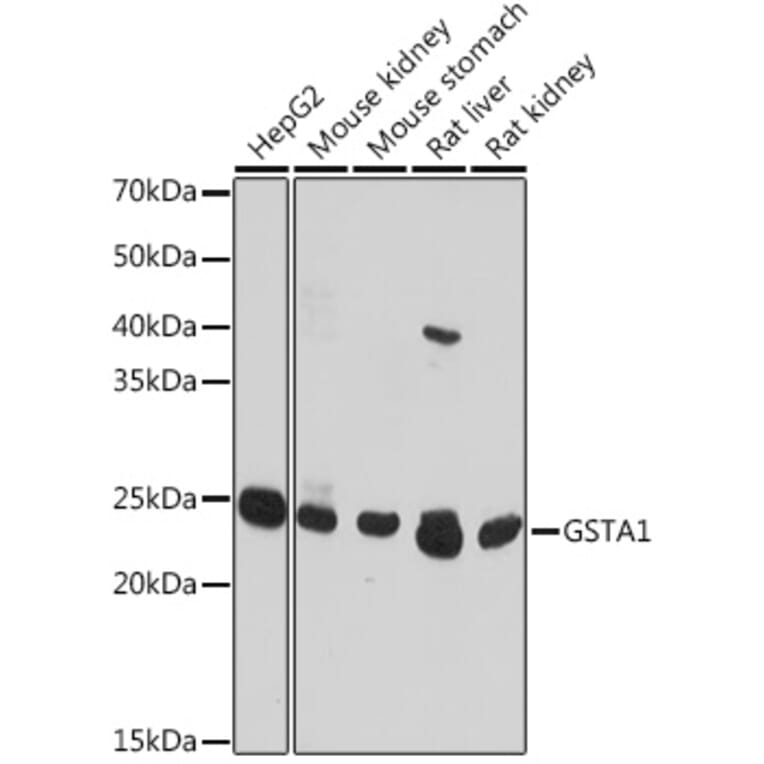 Western Blot - Anti-GSTA1 Antibody (A306872) - Antibodies.com