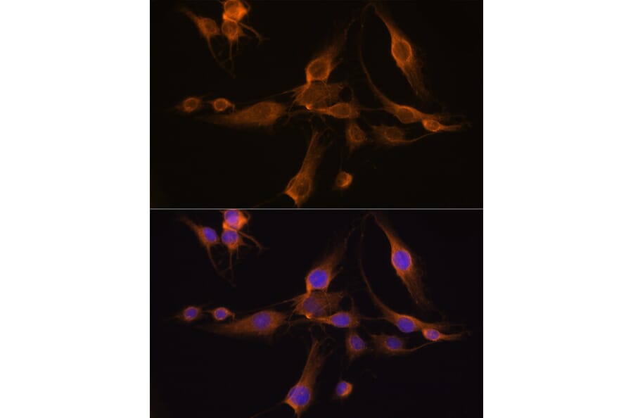 Immunofluorescence - Anti-GSTA1 Antibody (A306872) - Antibodies.com