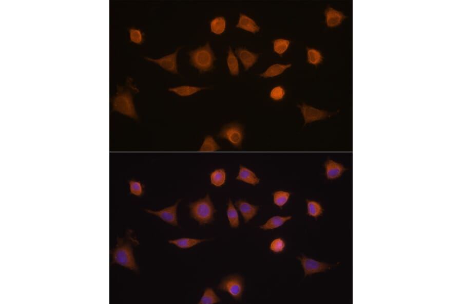 Immunofluorescence - Anti-GSTA1 Antibody (A306872) - Antibodies.com