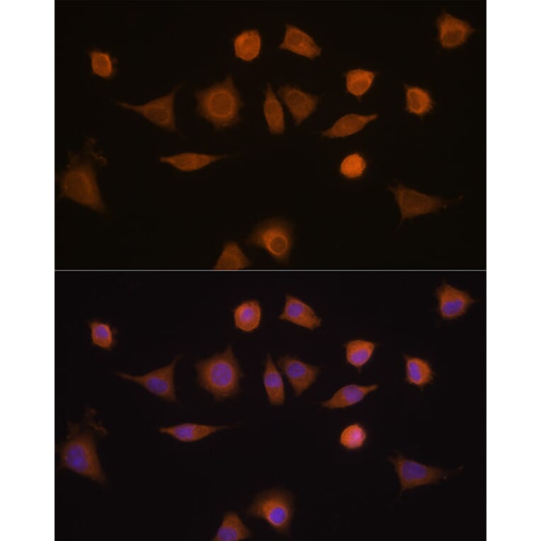 Immunofluorescence - Anti-GSTA1 Antibody (A306872) - Antibodies.com