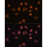 Immunofluorescence - Anti-GSTA1 Antibody (A306872) - Antibodies.com