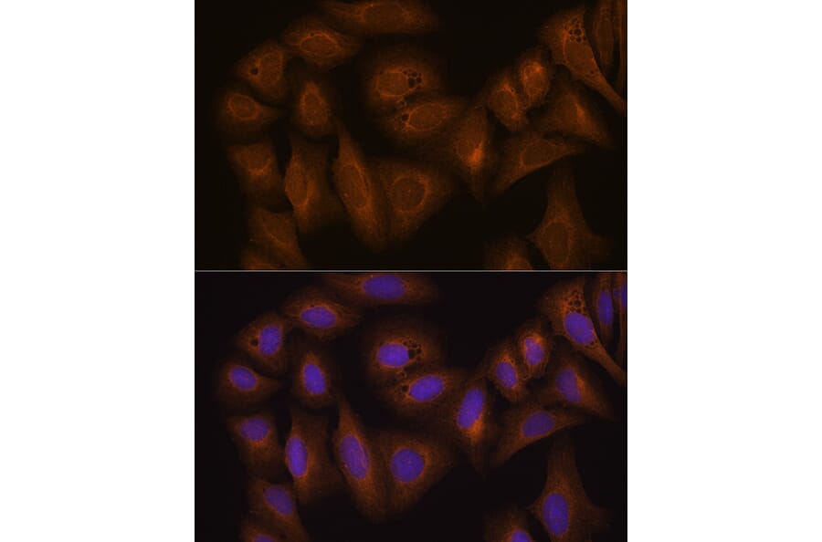 Immunofluorescence - Anti-GSTA1 Antibody (A306872) - Antibodies.com
