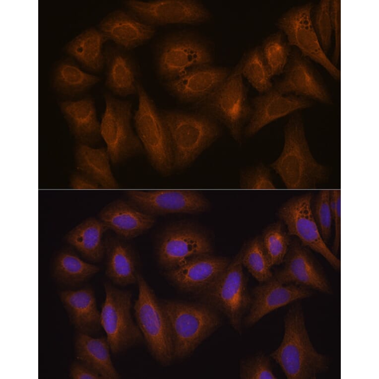 Immunofluorescence - Anti-GSTA1 Antibody (A306872) - Antibodies.com