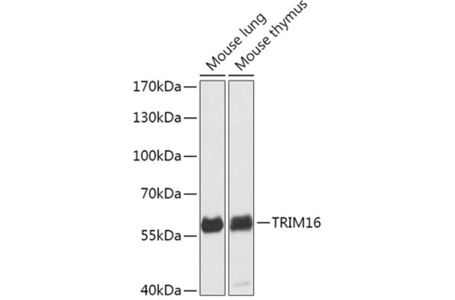 Western Blot - Anti-TRIM16 Antibody (A306873) - Antibodies.com