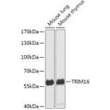 Western Blot - Anti-TRIM16 Antibody (A306873) - Antibodies.com