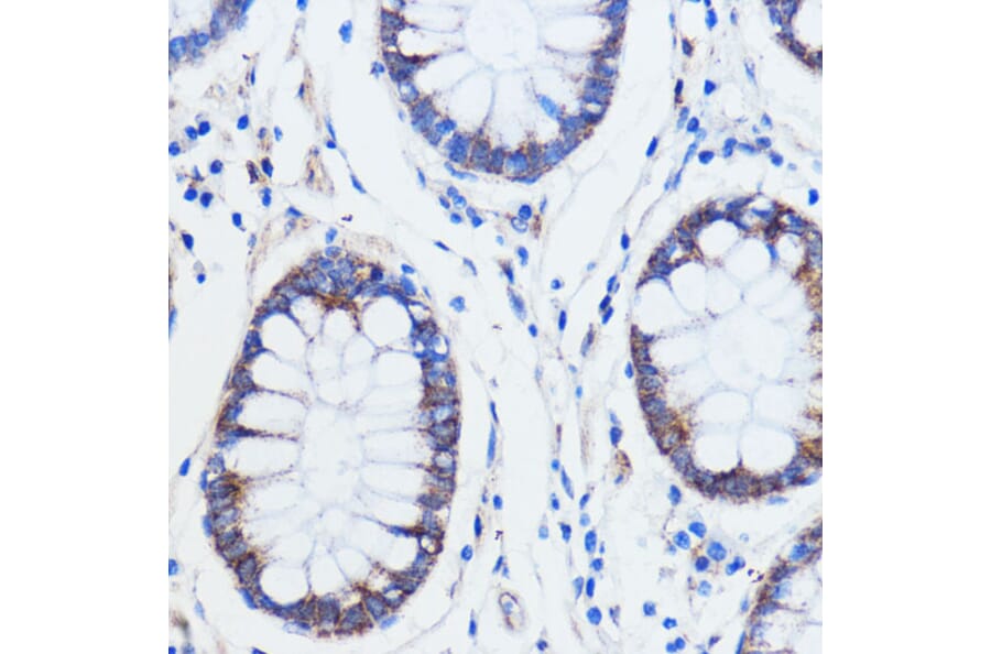 Immunohistochemistry - Anti-TRIM16 Antibody (A306873) - Antibodies.com