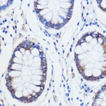 Immunohistochemistry - Anti-TRIM16 Antibody (A306873) - Antibodies.com