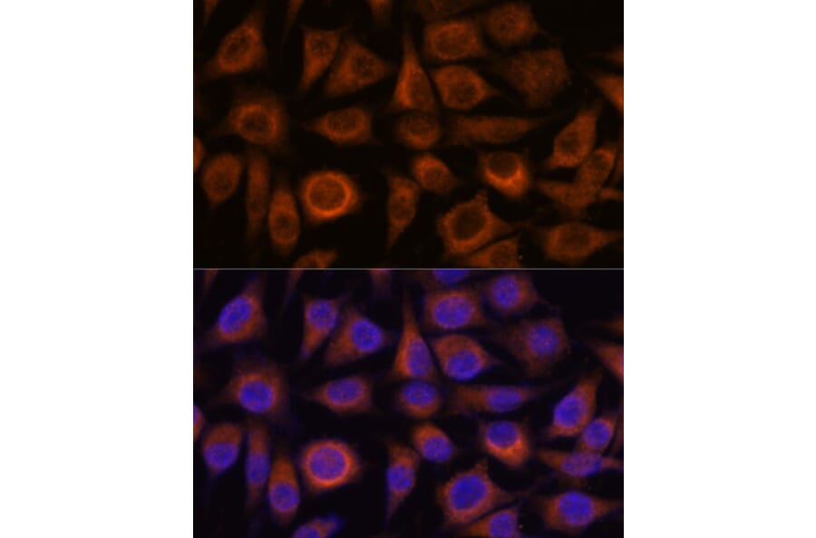 Immunofluorescence - Anti-TRIM16 Antibody (A306873) - Antibodies.com