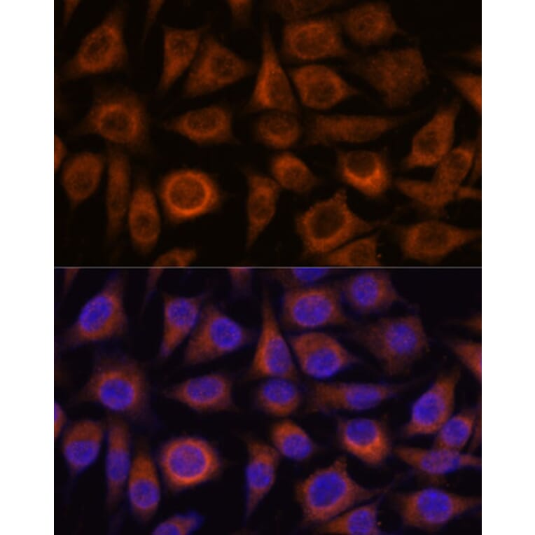 Immunofluorescence - Anti-TRIM16 Antibody (A306873) - Antibodies.com