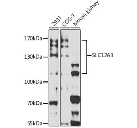 Western Blot - Anti-SLC12A3 Antibody (A306874) - Antibodies.com
