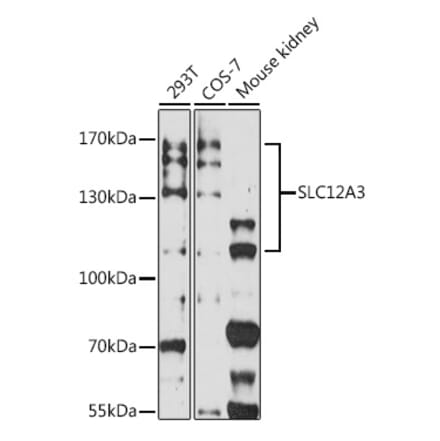 Western Blot - Anti-SLC12A3 Antibody (A306874) - Antibodies.com