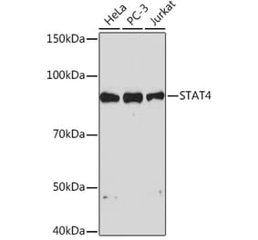 Western Blot - Anti-STAT4 Antibody [ARC1071] (A306876) - Antibodies.com