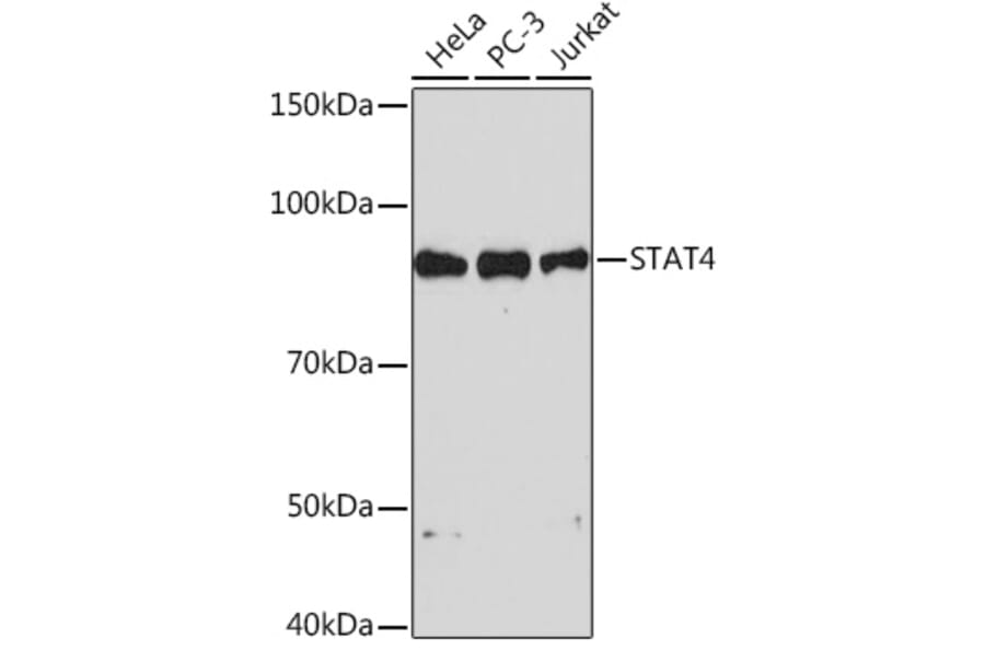 Western Blot - Anti-STAT4 Antibody [ARC1071] (A306876) - Antibodies.com