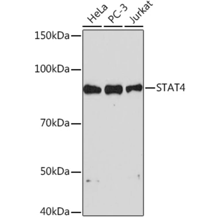 Western Blot - Anti-STAT4 Antibody [ARC1071] (A306876) - Antibodies.com