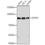 Western Blot - Anti-STAT4 Antibody [ARC1071] (A306876) - Antibodies.com