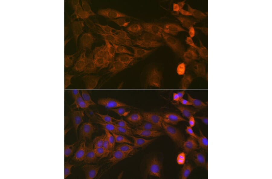 Immunofluorescence - Anti-STAT4 Antibody [ARC1071] (A306876) - Antibodies.com