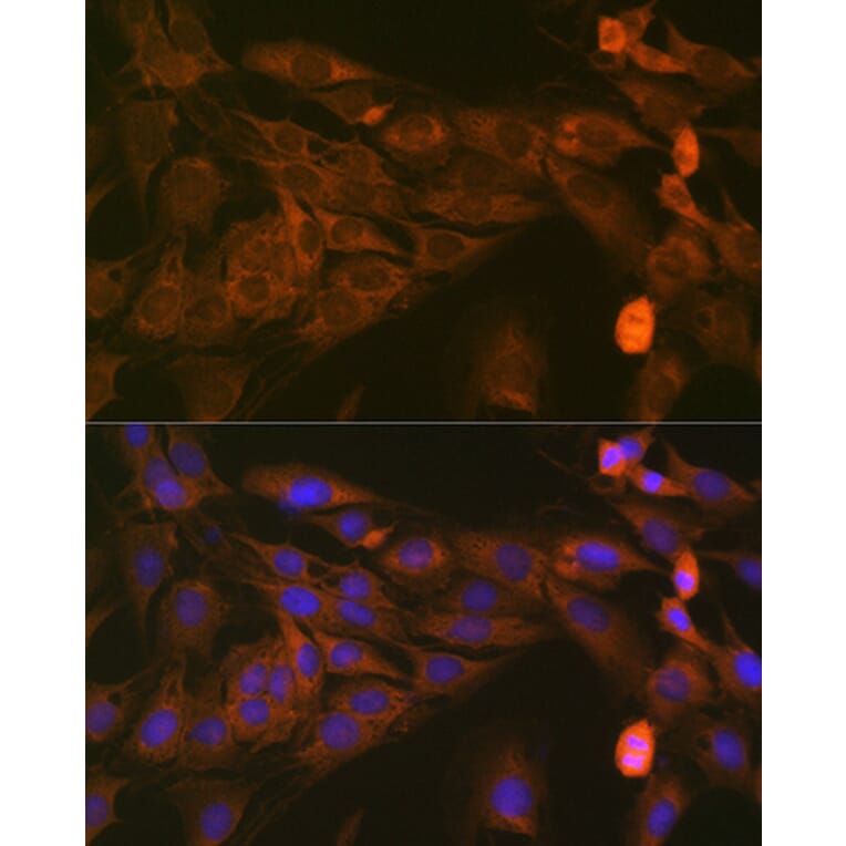 Immunofluorescence - Anti-STAT4 Antibody [ARC1071] (A306876) - Antibodies.com