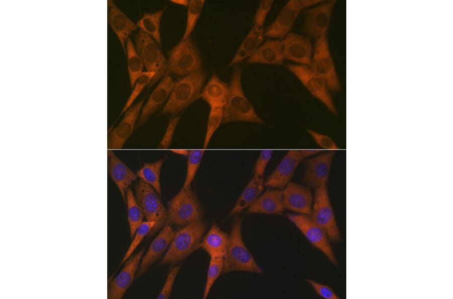 Immunofluorescence - Anti-STAT4 Antibody [ARC1071] (A306876) - Antibodies.com