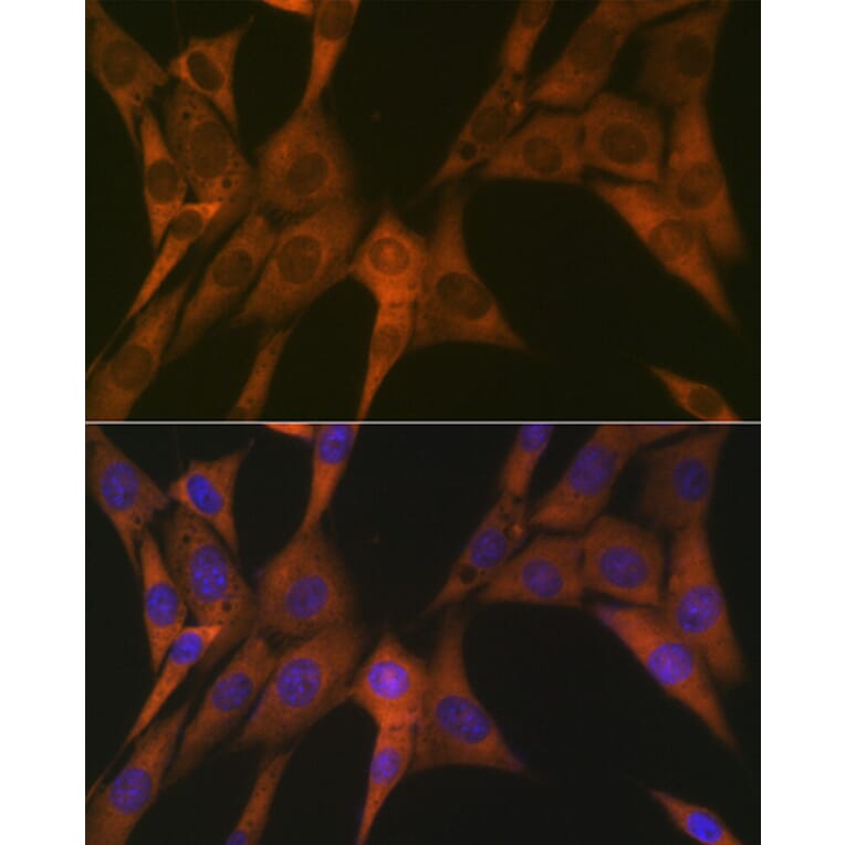 Immunofluorescence - Anti-STAT4 Antibody [ARC1071] (A306876) - Antibodies.com