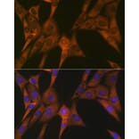 Immunofluorescence - Anti-STAT4 Antibody [ARC1071] (A306876) - Antibodies.com