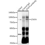 Western Blot - Anti-STAT4 Antibody [ARC1071] (A306876) - Antibodies.com