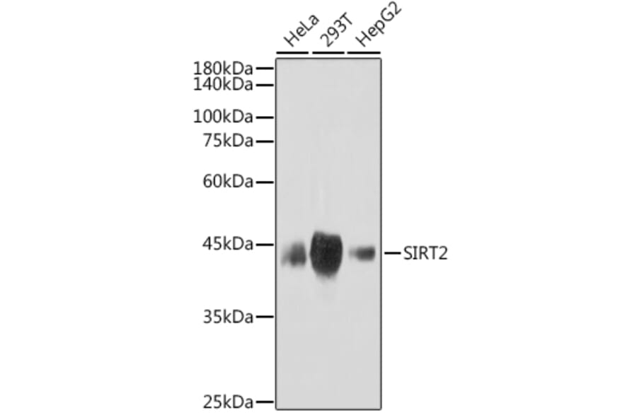 Western Blot - Anti-SIRT2 Antibody [ARC2644] (A306877) - Antibodies.com