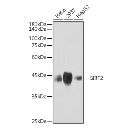 Western Blot - Anti-SIRT2 Antibody [ARC2644] (A306877) - Antibodies.com