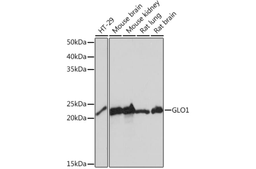 Western Blot - Anti-GLO1 Antibody [ARC0969] (A306878) - Antibodies.com