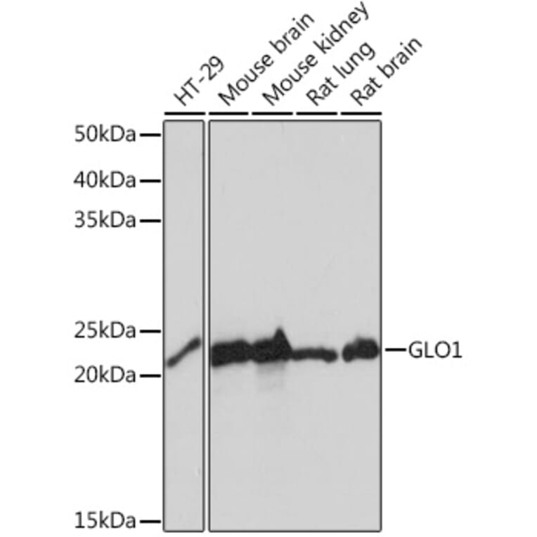 Western Blot - Anti-GLO1 Antibody [ARC0969] (A306878) - Antibodies.com