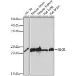 Western Blot - Anti-GLO1 Antibody [ARC0969] (A306878) - Antibodies.com