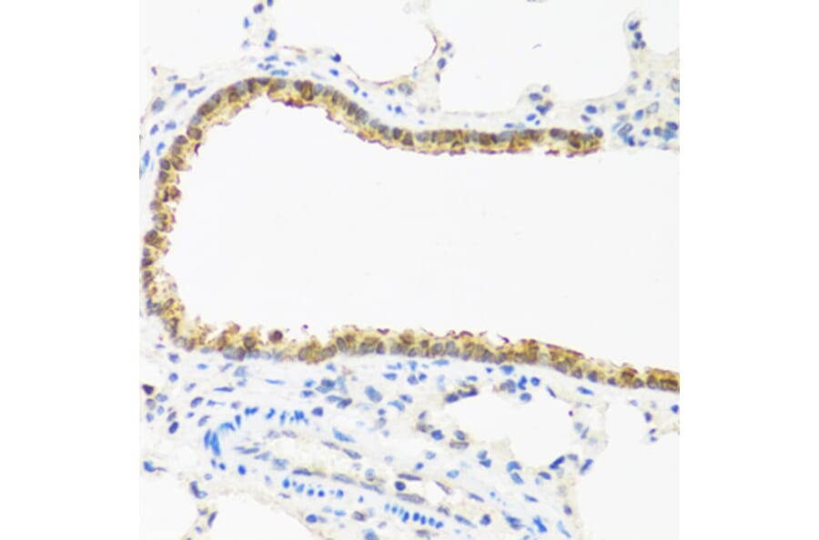 Immunohistochemistry - Anti-p18 INK4c / CDKN2C Antibody (A306880) - Antibodies.com
