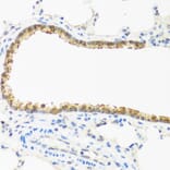 Immunohistochemistry - Anti-p18 INK4c / CDKN2C Antibody (A306880) - Antibodies.com